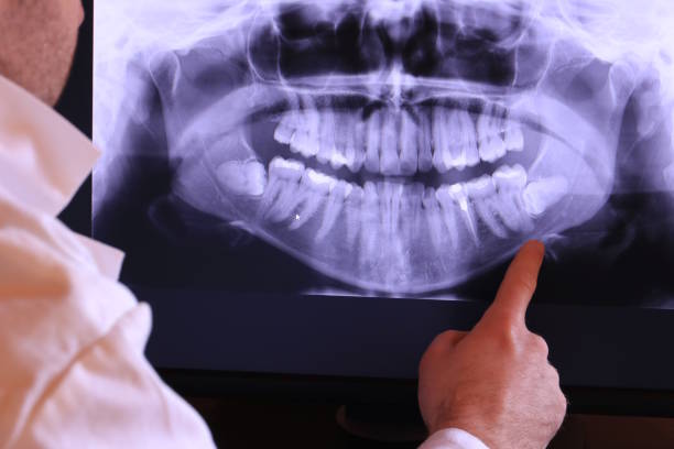 Best Broken or Chipped Tooth Repair in Elverson, PA