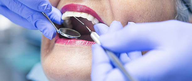 Best Knocked-Out Tooth (Avulsed Tooth) Treatment in Elverson, PA